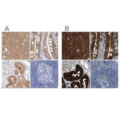 Immunohistochemistry-Paraffin: Guanine deaminase Antibody [NBP1-87454] - Staining of human cerebral cortex, duodenum, kidney and lymph node using Anti-GDA antibody NBP1-87454 (A) shows similar protein distribution across tissues to independent antibody NBP1-87562 (B).