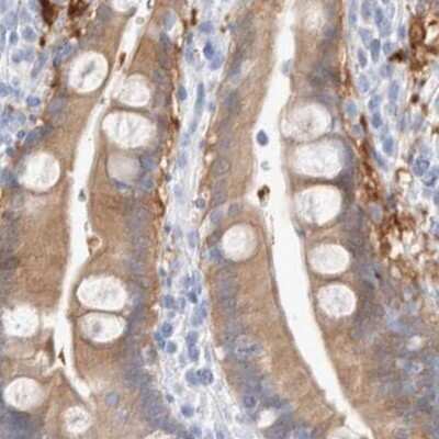 Immunohistochemistry-Paraffin: Guanine deaminase Antibody [NBP1-87454] - Staining of human duodenum.