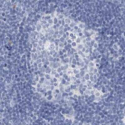 Immunohistochemistry-Paraffin: Guanine deaminase Antibody [NBP1-87454] - Staining of human lymph node using Anti-GDA antibody NBP1-87454.