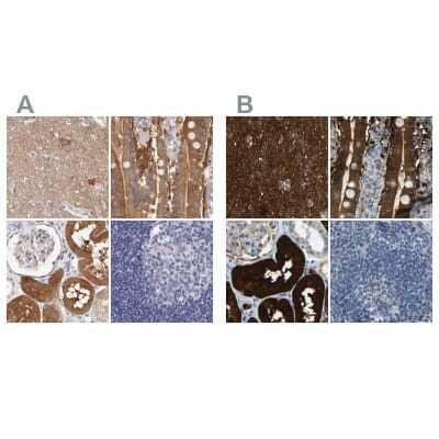 Immunohistochemistry-Paraffin: Guanine deaminase Antibody [NBP1-87525] - Staining of human cerebral cortex, duodenum, kidney and lymph node using Anti-GDA antibody NBP1-87525 (A) shows similar protein distribution across tissues to independent antibody NBP1-87562 (B).