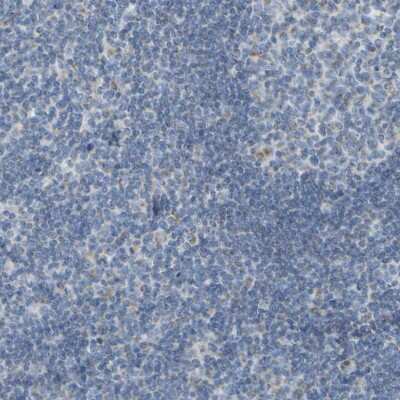Immunohistochemistry-Paraffin: Guanine deaminase Antibody [NBP1-87562] - Staining of human tonsil shows low expression as expected.