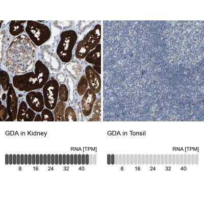 Immunohistochemistry-Paraffin: Guanine deaminase Antibody [NBP1-87562] - Staining in human kidney and tonsil tissues using anti-GDA antibody. Corresponding GDA RNA-seq data are presented for the same tissues.