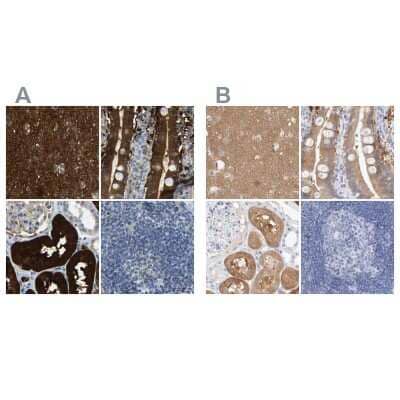 <b>Independent Antibodies Validation and Orthogonal Strategies Validation.</b>Immunohistochemistry-Paraffin: Guanine deaminase Antibody [NBP1-87562] - Staining of human cerebral cortex, duodenum, kidney and lymph node using Anti-GDA antibody NBP1-87562 (A) shows similar protein distribution across tissues to independent antibody NBP1-87454 (B).