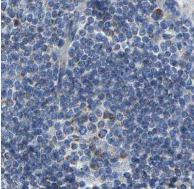Immunohistochemistry-Paraffin: Guanine deaminase Antibody [NBP1-87562] - Staining of human lymph node using Anti-GDA antibody.