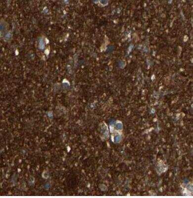 Immunohistochemistry-Paraffin: Guanine deaminase Antibody [NBP1-87562] - Staining of human cerebral cortex using Anti-GDA antibody.