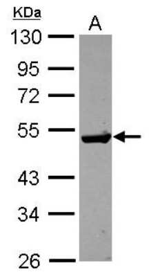 Western Blot: Guanine deaminase Antibody [NBP2-16769] - Sample (30 ug of whole cell lysate) A: HCT116 10% SDS PAGE gel, diluted at 1:1000.