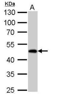Western Blot: Guanine deaminase Antibody [NBP2-16769] - A. 50 ug rat colon lysate/extract.