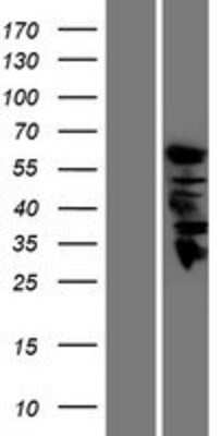 Western Blot: Guanine deaminase Overexpression Lysate (Adult Normal) [NBP2-10586] Left-Empty vector transfected control cell lysate (HEK293 cell lysate); Right -Over-expression Lysate for Guanine deaminase.