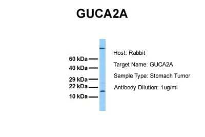 Western Blot: Guanylin Antibody [NBP2-82959] - Host: Rabbit. Target Name: GUCA2A. Sample Tissue: Human Stomach Tumor. Antibody Dilution: 1.0ug/ml