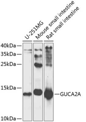 Western Blot: Guanylin Antibody [NBP3-03580] - Analysis of extracts of various cell lines, using Guanylin antibody at 1:1000 dilution. Secondary antibody: HRP Goat Anti-Rabbit IgG (H+L) at 1:10000 dilution. Lysates/proteins: 25ug per lane. Blocking buffer: 3% nonfat dry milk in TBST. Detection: ECL Enhanced Kit.