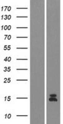 Western Blot: Guanylin Overexpression Lysate (Adult Normal) [NBP2-05849] Left-Empty vector transfected control cell lysate (HEK293 cell lysate); Right -Over-expression Lysate for Guanylin.