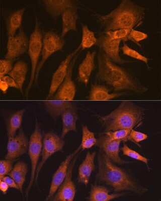 Immunocytochemistry/Immunofluorescence: Guanylyl Cyclase beta 1 Antibody (5O8D9) [NBP3-16248] - Immunofluorescence analysis of NIH-3T3 cells using Guanylyl Cyclase beta 1 (GUCY1B3) Rabbit mAb (NBP3-16248) at dilution of 1:100 (40x lens). Blue: DAPI for nuclear staining.