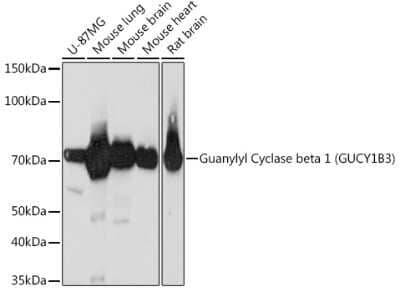 Western Blot: Guanylyl Cyclase beta 1 Antibody (5O8D9) [NBP3-16248] - Analysis of extracts of various cell lines, using Guanylyl Cyclase beta 1 (GUCY1B3) Rabbit mAb (NBP3-16248) at 1:1000 dilution. Secondary antibody: HRP Goat Anti-Rabbit IgG (H+L) at 1:10000 dilution. Lysates/proteins: 25ug per lane. Blocking buffer: 3% nonfat dry milk in TBST. Detection: ECL Basic Kit. Exposure time: 3min.