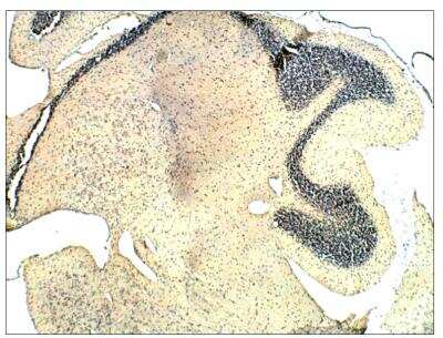 Immunohistochemistry: Guanylyl Cyclase beta 1 Antibody [NBP3-18694] - Rat cerebellum - soluble guanylate cyclase beta 1 primary antibody (1:100) in IHC blocking buffer. DAB (brown) staining and hematoxylin QS (blue) counterstain. 5X maginification on Leica DM4000 microscope. FFPE section.