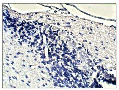 Immunohistochemistry: Guanylyl Cyclase beta 1 Antibody [NBP3-18694] - Rat cerebellum - soluble Guanylyl Cyclase beta 1 antibody (1:100) in IHC blocking buffer. DAB (brown) staining and hematoxylin QS (blue) counterstain. 40X magnification on Leica DM4000 microscope. FFPE section.