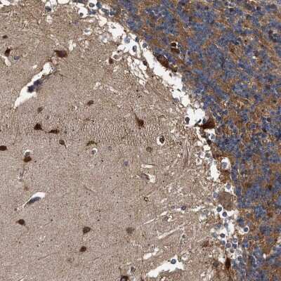 Immunohistochemistry-Paraffin: Guanylyl Cyclase beta 1 Antibody [NBP1-89784] - Staining of human cerebellum shows strong cytoplasmic positivity in molecular layer.