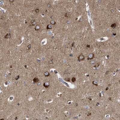 Immunohistochemistry-Paraffin: Guanylyl Cyclase beta 1 Antibody [NBP1-89784] - Staining of human cerebral cortex shows strong cytoplasmic positivity in neurons.