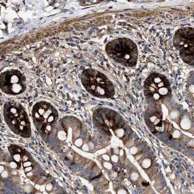 Immunohistochemistry-Paraffin: Guanylyl Cyclase beta 1 Antibody [NBP1-89784] - Staining of human gastrointestinal shows strong cytoplasmic positivity in glandular cells.