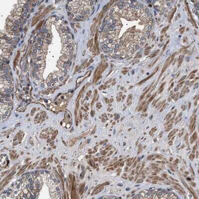 Immunohistochemistry-Paraffin: Guanylyl Cyclase beta 1 Antibody [NBP1-89784] - Staining of human prostate shows strong cytoplasmic positivity in smooth muscle cells.