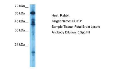 Western Blot: Guanylyl Cyclase beta 1 Antibody [NBP1-58869] - Fetal Brain lysates, Antibody Dilution: 0.5 ug/ml.