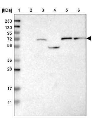 Western Blot: Guanylyl Cyclase beta 1 Antibody [NBP1-89784] - Lane 1: Marker  [kDa] 230, 130, 95, 72, 56, 36, 28, 17, 11.  Lane 2: Human cell line RT-4.  Lane 3: Human cell line U-251MG sp.  Lane 4: Human plasma (IgG/HSA depleted).  Lane 5: Human liver tissue.  Lane 6: Human tonsil tissue