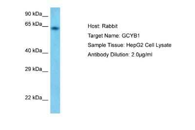 Western Blot: Guanylyl Cyclase beta 1 Antibody [NBP2-85021] - Host: Rabbit. Target Name: GUCY1B3. Sample Tissue: Human HepG2 Whole cell. Antibody Dilution: 1ug/ml