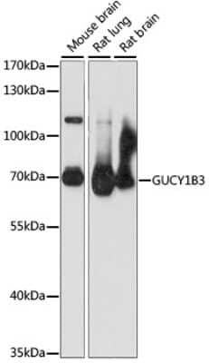 Western Blot: Guanylyl Cyclase beta 1 Antibody [NBP3-03389] - Analysis of extracts of various cell lines, using Guanylyl Cyclase beta 1 antibody at 1:1000 dilution. Secondary antibody: HRP Goat Anti-Rabbit IgG (H+L) at 1:10000 dilution. Lysates/proteins: 25ug per lane. Blocking buffer: 3% nonfat dry milk in TBST.