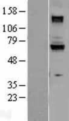 Western Blot: Guanylyl Cyclase beta 1 Overexpression Lysate (Adult Normal) [NBL1-11408] Left-Empty vector transfected control cell lysate (HEK293 cell lysate); Right -Over-expression Lysate for Guanylyl Cyclase beta 1.