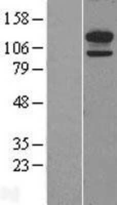 Western Blot Cadherin-13 Overexpression Lysate