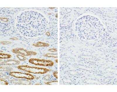 Immunohistochemistry-Paraffin: H.O.H.(TM) (Human on Human) Immunodetection Kit [HOH-3000-NB] - Serial sections of human kidney (FFPE). Left image shows strong, specific staining(brown) using human anti-cytokeratin primary antibody and detected withHOH-3000. Right image is a negative control showing absence of staining (nobackground) with the omission of just the primary antibody in the HOH-3000assay. Both sections counterstained with hematoxylin (blue nuclei).