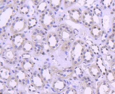 Immunohistochemistry-Paraffin: H1F0 Antibody (SD206-04) [NBP2-67752] - Analysis of paraffin-embedded human kidney tissue using anti-Histone H1.0 antibody. Counter stained with hematoxylin.