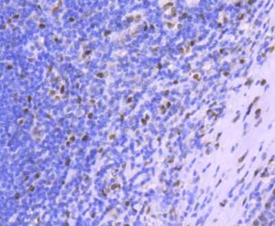 Immunohistochemistry-Paraffin: H1F0 Antibody (SD206-04) [NBP2-67752] - Analysis of paraffin-embedded human tonsil tissue using anti-Histone H1.0 antibody. Counter stained with hematoxylin.