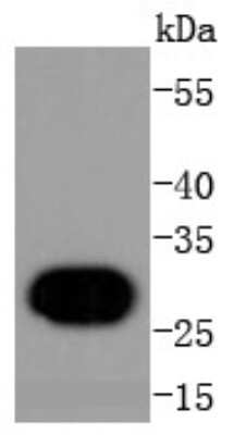 Western Blot: H1F0 Antibody (SD206-04) [NBP2-67752] - Analysis of Histone H1.0 on human lung lysates using anti-Histone H1.0 antibody at 1/1,000 dilution.
