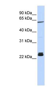 Western Blot: H1F0 Antibody [NBP1-53000] - Hela cell lysate, concentration 0.2-1 ug/ml.