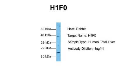 Western Blot: H1F0 Antibody [NBP1-53000] - Sample Tissue: Human Fetal Liver Antibody Dilution: 1.0 ug/ml
