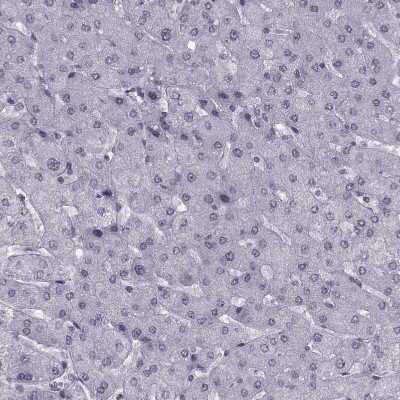 Immunohistochemistry-Paraffin: H1FOO Antibody [NBP1-86265] - Staining of human Liver shows no positivity in hepatocytes as expected.