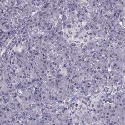 Immunohistochemistry-Paraffin: H1FOO Antibody [NBP1-86265] - Staining of human Pancreas shows no positivity in exocrine glandular cells as expected.