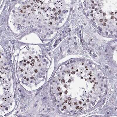 Immunohistochemistry-Paraffin: H1FOO Antibody [NBP1-86265] - Staining of human Testis shows moderate nuclear positivity in spermatids.