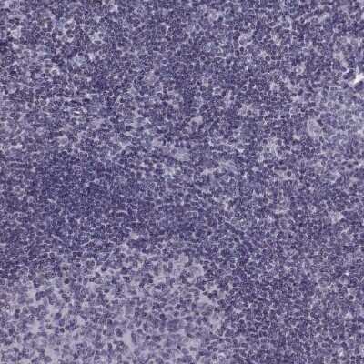 Immunohistochemistry-Paraffin: H1FOO Antibody [NBP1-86265] - Staining of human Tonsil shows no positivity in non-germinal center cells as expected.