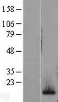 Western Blot H2AFV Overexpression Lysate