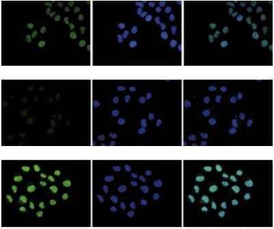 Immunofluorescence: H2AZ Antibody [NBP2-54618] - HeLa cells were stained with the antibody against H2A.Z. and with DAPI. Cells were fixed with 4% formaldehyde for 10' and blocked with PBS/TX-100 containing 5% normal goat serum and 1% BSA. Top Figure: cells were immunofluorescently labeled with the H2A.Z antibody (left) diluted 1:500 in blocking solution followed by an anti-rabbit antibody conjugated to Alexa488. The middle panel shows staining of the nuclei with DAPI. A merge of the two stainings is shown on the right. Middle Figure and lower Figure: staining of the cells with the H2A.Z antibody after incubation of the antibody with 10 ng/ul of the peptide used for immunisation of the rabbit (middle Figure) and with a peptide containing a sequence from the central part of the H2A.Z protein (lower Figure).