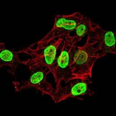 Immunocytochemistry/Immunofluorescence: H4/n Antibody (3E7D9) [NBP2-52487] - Immunofluorescence analysis of HeLa cells using HIST2H4A(20Me) mouse mAb (green). Blue: DRAQ5 fluorescent DNA dye. Red: Actin filaments have been labeled with Alexa Fluor- 555 phalloidin.