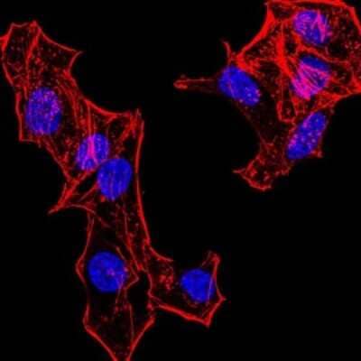 Immunocytochemistry/Immunofluorescence: H4/n Antibody (3E7H2) [NBP2-52486] - Analysis of HeLa cells. Blue: DRAQ5 fluorescent DNA dye. Red: Actin filaments have been labeled with Alexa Fluor- 555 phalloidin.