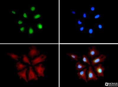 Immunocytochemistry/Immunofluorescence: HA95/AKAP8L Antibody [NBP1-79140] - HA95/AKAP8L antibody was tested in HeLa cells with DyLight 488 (green). Nuclei and alpha Tubulin (NB100-690) were counterstained with DAPI (blue) and DyLight 550 (red).