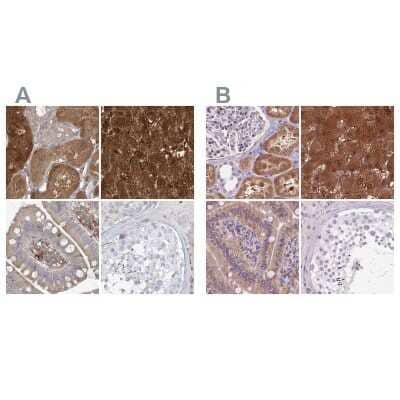 <b>Independent Antibodies Validation. </b>Immunohistochemistry-Paraffin: HAAO Antibody [NBP1-85892] - Staining of human kidney, liver, small intestine and testis using Anti-HAAO antibody NBP1-85892 (A) shows similar protein distribution across tissues to independent antibody NBP2-48755 (B).