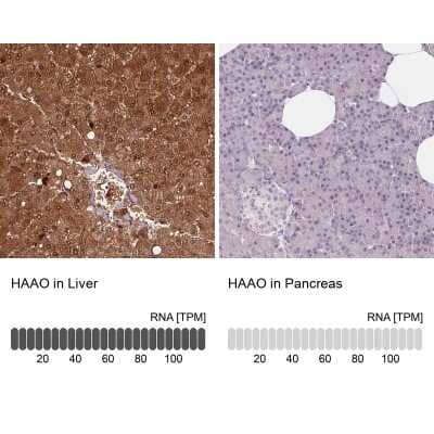 <b>Orthogonal Strategies Validation. </b>Immunohistochemistry-Paraffin: HAAO Antibody [NBP2-48755] - Staining in human liver and pancreas tissues using anti-HAAO antibody. Corresponding HAAO RNA-seq data are presented for the same tissues.