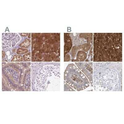 <b>Independent Antibodies Validation. </b>Immunohistochemistry-Paraffin: HAAO Antibody [NBP2-48755] - Staining of human kidney, liver, small intestine and testis using Anti-HAAO antibody NBP2-48755 (A) shows similar protein distribution across tissues to independent antibody NBP1-85892 (B).