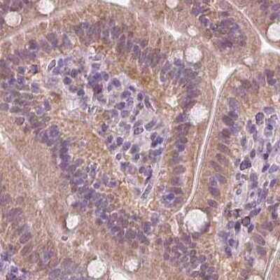 Immunohistochemistry-Paraffin: HAAO Antibody [NBP2-48755] - Staining of human small intestine.