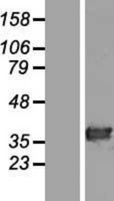 Western Blot: HAAO Overexpression Lysate (Adult Normal) [NBL1-11431] Left-Empty vector transfected control cell lysate (HEK293 cell lysate); Right -Over-expression Lysate for HAAO.