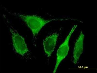 Immunocytochemistry/Immunofluorescence: HABP1/C1QBP/GC1q R Antibody [H00000708-B01P] - Analysis of purified antibody to C1QBP on HeLa cell. (antibody concentration 10 ug/ml)